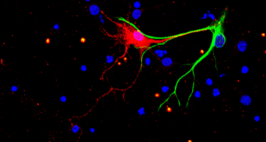 Unidad de Bases Moleculares de la Neurodegeneración